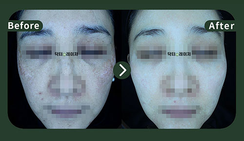 [기미] 40대 전후사진