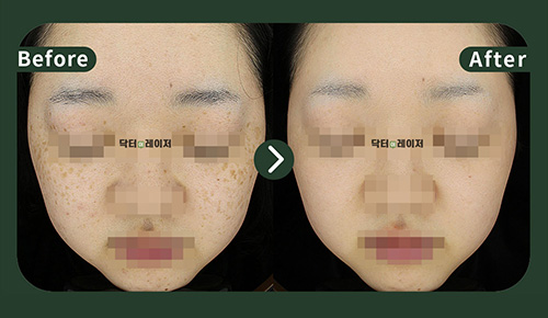 [기미] 20대 전후사진
