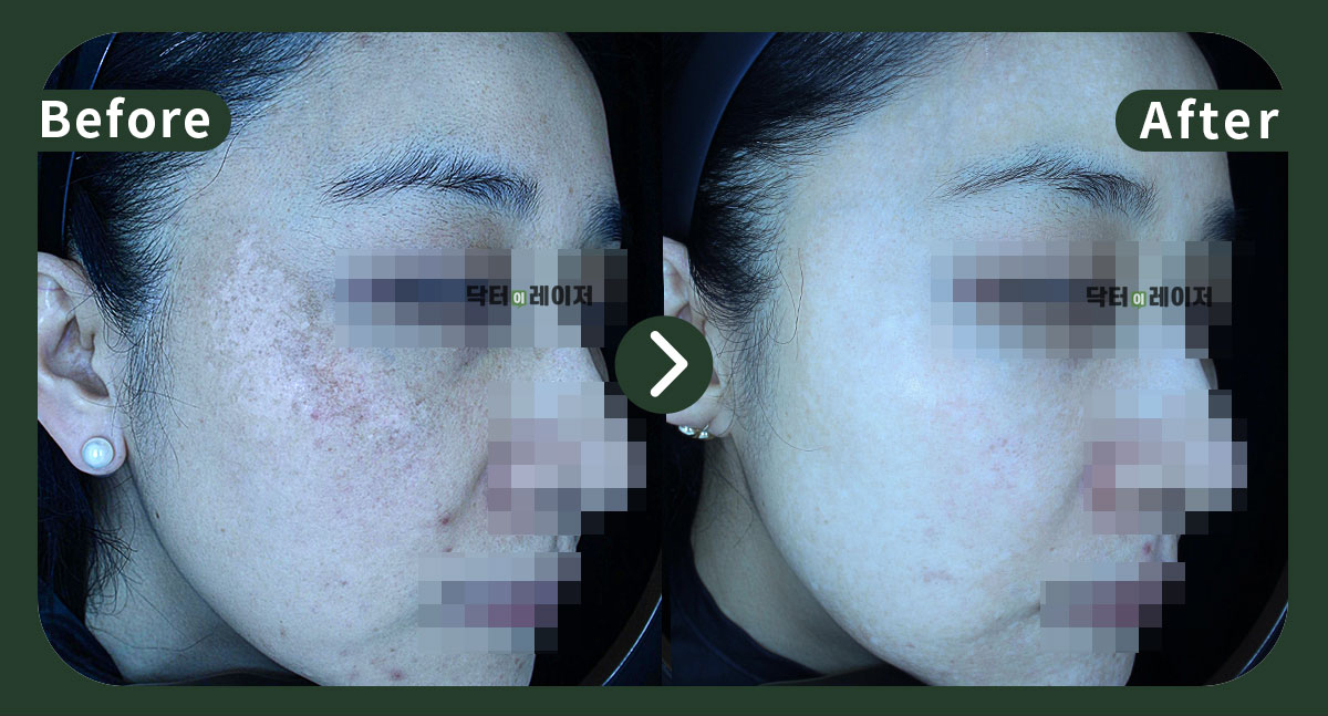 [기미] 40대 전후사진
