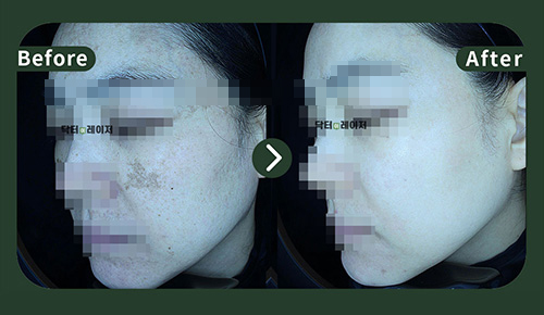 [기미] 40대 전후사진