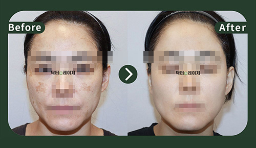 [기미] 40대 전후사진